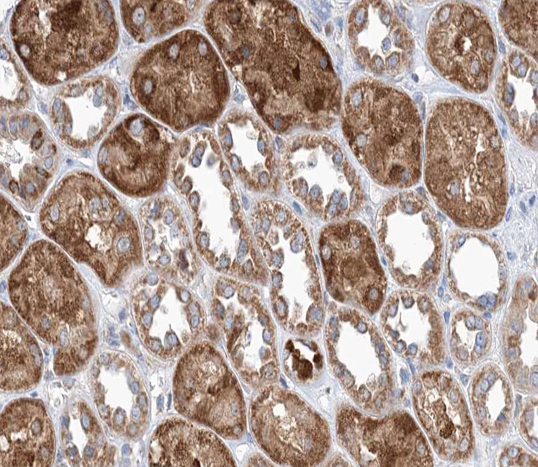 KRT18 / CK18 / Cytokeratin 18 Antibody - 1:200 staining human kidney tissue by IHC-P. The tissue was formaldehyde fixed and a heat mediated antigen retrieval step in citrate buffer was performed. The tissue was then blocked and incubated with the antibody for 1.5 hours at 22°C. An HRP conjugated goat anti-rabbit antibody was used as the secondary.