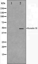 KRT18 / CK18 / Cytokeratin 18 Antibody - Western blot analysis on HT29 cell lysates using Keratin 18 antibody. The lane on the left is treated with the antigen-specific peptide.