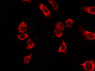 KRT18 / CK18 / Cytokeratin 18 Antibody - Staining HT29 cells by IF/ICC. The samples were fixed with PFA and permeabilized in 0.1% Triton X-100, then blocked in 10% serum for 45 min at 25°C. The primary antibody was diluted at 1:200 and incubated with the sample for 1 hour at 37°C. An Alexa Fluor 594 conjugated goat anti-rabbit IgG (H+L) Ab, diluted at 1/600, was used as the secondary antibody.