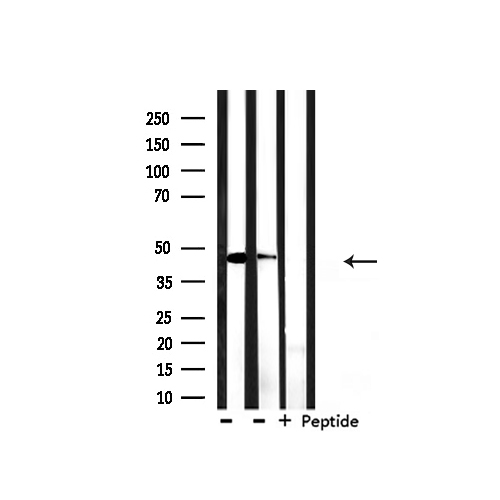 KRT18 / CK18 / Cytokeratin 18 Antibody - Western blot analysis of extracts of HepG2, mouse spleen using Keratin 18 antibody.