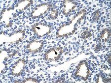 KRT18 / CK18 / Cytokeratin 18 Antibody - KRT18 / Cytokeratin 18 antibody ARP40205_T100-NP_000215-KRT18 (keratin 18) Antibody was used in IHC to stain formalin-fixed, paraffin-embedded human lung.  This image was taken for the unconjugated form of this product. Other forms have not been tested.