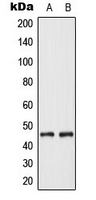 KRT18 / CK18 / Cytokeratin 18 Antibody - Western blot analysis of Cytokeratin 18 expression in MCF7 (A); Jurkat (B) whole cell lysates.
