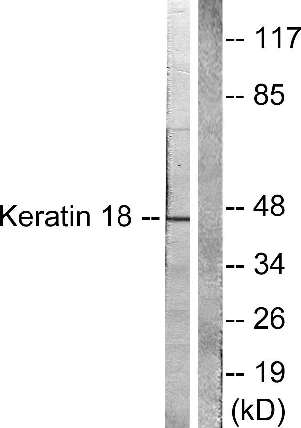 KRT18 / CK18 / Cytokeratin 18 Antibody - Western blot analysis of extracts from Hela cells treated with UV (5min), using Keratin 18 (Ab-33) antibody ( Line 1 and 2).