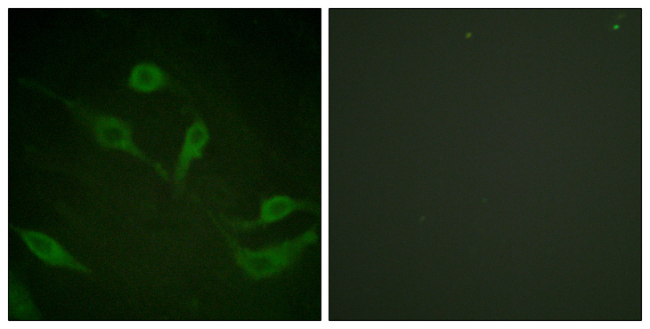 KRT18 / CK18 / Cytokeratin 18 Antibody - Immunofluorescence analysis of HeLa cells, using Keratin 18 (Phospho-Ser33) Antibody. The picture on the right is blocked with the phospho peptide.