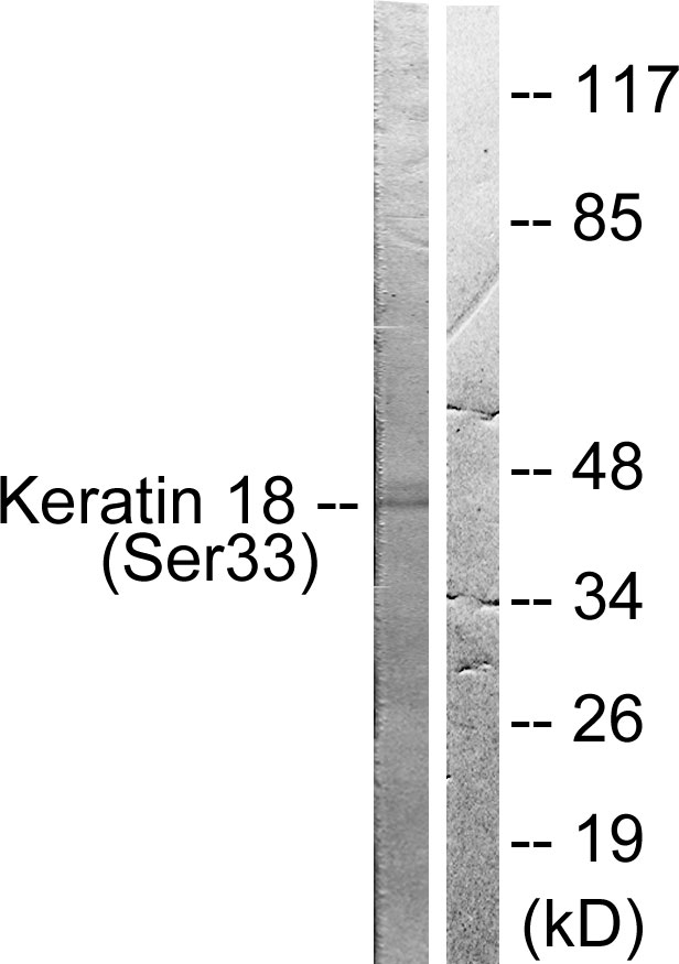 KRT18 / CK18 / Cytokeratin 18 Antibody - Western blot analysis of lysates from HT29 cells, using Keratin 18 (Phospho-Ser33) Antibody. The lane on the right is blocked with the phospho peptide.
