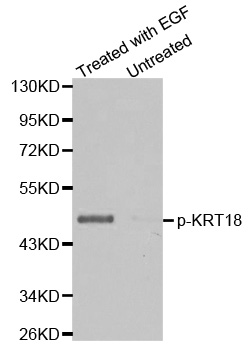 KRT18 / CK18 / Cytokeratin 18 Antibody - Western blot analysis of extracts from HT29 cells untreated or treated with EGF.