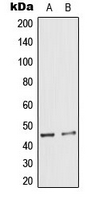 KRT18 / CK18 / Cytokeratin 18 Antibody - Western blot analysis of Cytokeratin 18 (pS33) expression in A431 (A); HeLa (B) whole cell lysates.