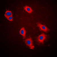 KRT18 / CK18 / Cytokeratin 18 Antibody - Immunofluorescent analysis of Cytokeratin 18 (pS33) staining in A431 cells. Formalin-fixed cells were permeabilized with 0.1% Triton X-100 in TBS for 5-10 minutes and blocked with 3% BSA-PBS for 30 minutes at room temperature. Cells were probed with the primary antibody in 3% BSA-PBS and incubated overnight at 4 C in a humidified chamber. Cells were washed with PBST and incubated with a DyLight 594-conjugated secondary antibody (red) in PBS at room temperature in the dark. DAPI was used to stain the cell nuclei (blue).