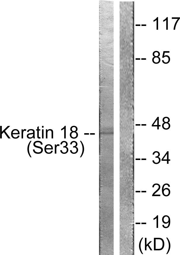 KRT18 / CK18 / Cytokeratin 18 Antibody - Western blot analysis of extracts from HT29 cells, using Keratin 18 (phospho-Ser33) antibody.