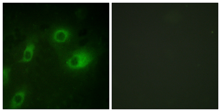 KRT18 / CK18 / Cytokeratin 18 Antibody - Immunofluorescence analysis of HeLa cells, using Keratin 18 (Phospho-Ser52) Antibody. The picture on the right is blocked with the phospho peptide.