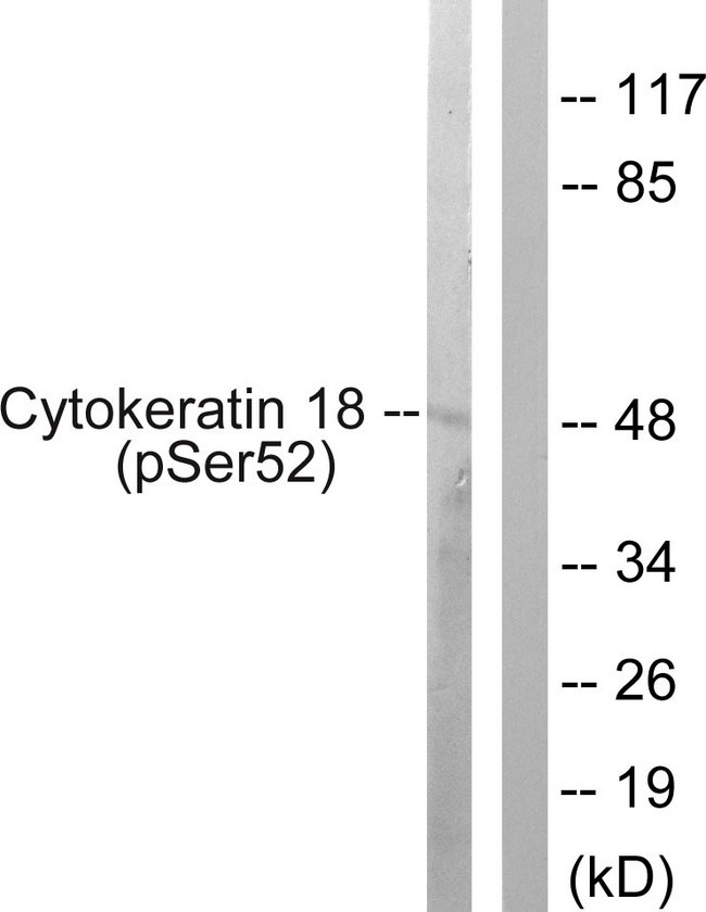 KRT18 / CK18 / Cytokeratin 18 Antibody - Western blot analysis of lysates from HepG2 cells, using Keratin 18 (Phospho-Ser52) Antibody. The lane on the right is blocked with the phospho peptide.