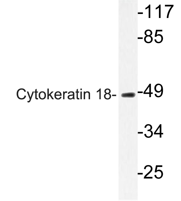 KRT18 / CK18 / Cytokeratin 18 Antibody - Western blot of Cytokeratin 18 (S48) pAb in extracts from HUVEC cells.