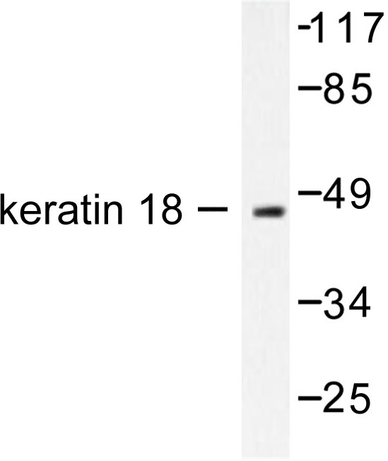 KRT18 / CK18 / Cytokeratin 18 Antibody - Western blot of Cytokeratin 18 (T410) pAb in extracts from HeLa cells.