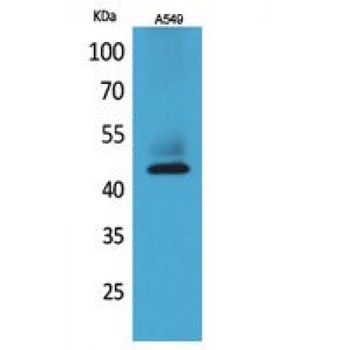 KRT19 / CK19 / Cytokeratin 19 Antibody - Western blot of Cytokeratin 19 antibody