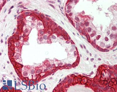 KRT19 / CK19 / Cytokeratin 19 Antibody - Human Prostate: Formalin-Fixed, Paraffin-Embedded (FFPE).  This image was taken for the unconjugated form of this product. Other forms have not been tested.