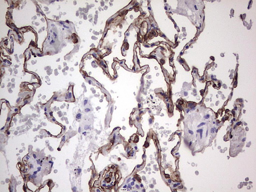 KRT19 / CK19 / Cytokeratin 19 Antibody - IHC of paraffin-embedded Human lung tissue using anti-KRT19 mouse monoclonal antibody. (Heat-induced epitope retrieval by 1 mM EDTA in 10mM Tris, pH8.5, 120°C for 3min).