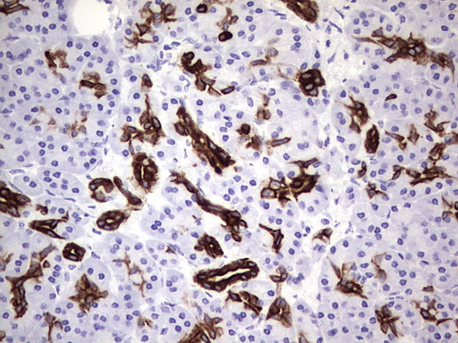 KRT19 / CK19 / Cytokeratin 19 Antibody - IHC of paraffin-embedded Human pancreas tissue using anti-KRT19 mouse monoclonal antibody. (Heat-induced epitope retrieval by 1 mM EDTA in 10mM Tris, pH8.5, 120°C for 3min).