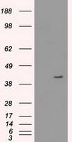 KRT19 / CK19 / Cytokeratin 19 Antibody - HEK293T cells were transfected with the pCMV6-ENTRY control (Left lane) or pCMV6-ENTRY KRT19 (Right lane) cDNA for 48 hrs and lysed. Equivalent amounts of cell lysates (5 ug per lane) were separated by SDS-PAGE and immunoblotted with anti-KRT19.