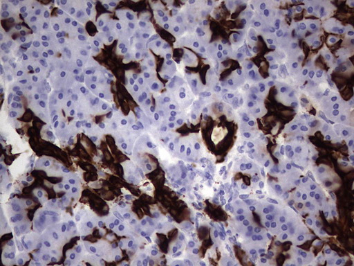 KRT19 / CK19 / Cytokeratin 19 Antibody - IHC of paraffin-embedded Human pancreas tissue using anti-KRT19 mouse monoclonal antibody. (Heat-induced epitope retrieval by 1 mM EDTA in 10mM Tris, pH8.5, 120°C for 3min).