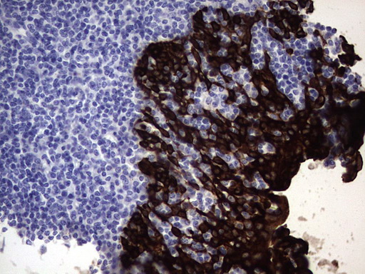 KRT19 / CK19 / Cytokeratin 19 Antibody - IHC of paraffin-embedded Human tonsil using anti-KRT19 mouse monoclonal antibody. (Heat-induced epitope retrieval by 1 mM EDTA in 10mM Tris, pH8.5, 120°C for 3min).
