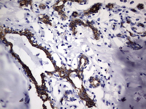 KRT19 / CK19 / Cytokeratin 19 Antibody - Immunohistochemical staining of paraffin-embedded Human breast tissue within the normal limits using anti-KRT19 mouse monoclonal antibody. (Heat-induced epitope retrieval by 1 mM EDTA in 10mM Tris, pH8.5, 120C for 3min,