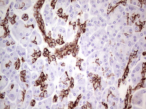 KRT19 / CK19 / Cytokeratin 19 Antibody - Immunohistochemical staining of paraffin-embedded Human pancreas tissue using anti-KRT19 mouse monoclonal antibody. (Heat-induced epitope retrieval by 1mM EDTA in 10mM Tris buffer. (pH9.0) at 120C for 3 min. (1:200)