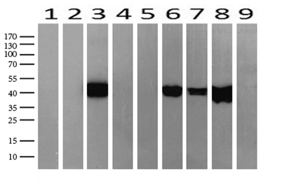 KRT19 / CK19 / Cytokeratin 19 Antibody - Western blot analysis of extracts. (15ug) from 9 Human tissue by using anti-KRT19 monoclonal antibody. (1: Testis; 2: Uterus; 3: Breast; 4: Brain; 5: Liver; 6: Ovary; 7: Thyroid gland; 8: colon:;9:Spleen). (1:500) Dilution: 1:500