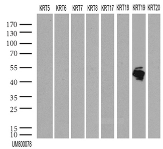 KRT19 / CK19 / Cytokeratin 19 Antibody - HEK293T were transfected with 55 different plasmids of CK cDNA. (1, 2, 4, 5, 6a, 6b, 6c, 7, 8, 9, 12, 13, 14, 15, 16, 17, 18 v1, 18 v2, 19, 20, 24, 25, 26, 27, 28, 31, 32, 33a, 33b, 34, 35, 36, 37, 38, 39, 40, 71, 72 v1, 72 v3, 73, 74, 75, 76, 77, 78, 79, 80 v1, 80 v2, 81, 82, 83, 84, 85, 86 and 222) for 48 hrs and lysed. Cell lysates. (5 ug per lane) were separated by SDS-PAGE and blotted with KRT19 antibody. Only KRT19 was positive, while all the thers were negative. (1:2000)