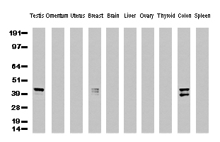 KRT19 / CK19 / Cytokeratin 19 Antibody - Western Blot analysis of 10 different human tissue lysates. (10ug) by using anti-CK19 monoclonal antibody. (clone UMAB2, 1:500)