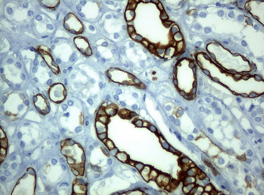KRT19 / CK19 / Cytokeratin 19 Antibody - Immunohistochemical staining of paraffin-embedded Kidney tissue using anti-KRT19mouse monoclonal antibody. (Clone UMAB2, dilution 1:100; heat-induced epitope retrieval by 10mM citric buffer, pH6.0, 120C for 3min)