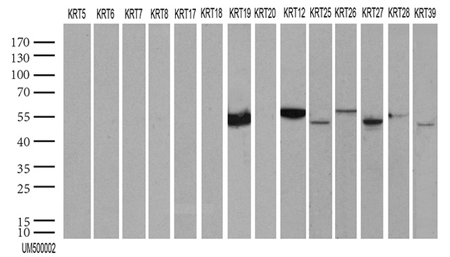 KRT19 / CK19 / Cytokeratin 19 Antibody - HEK293T were transfected with 55 different plasmids of CK cDNA. (1, 2, 4, 5, 6a, 6b, 6c, 7, 8, 9, 12, 13, 14, 15, 16, 17, 18 v1, 18 v2, 19, 20, 24, 25, 26, 27, 28, 31, 32, 33a, 33b, 34, 35, 36, 37, 38, 39, 40, 71, 72 v1, 72 v3, 73, 74, 75, 76, 77, 78, 79, 80 v1, 80 v2, 81, 82, 83, 84, 85, 86 and 222) for 48hrs and lysed. Cell lysates. (5 ug per lane) were separated by SDS-PAGE and blotted with KRT19 antibody. KRT12, 19, 25, 26, 27, 28 and 39 were positive, while all others were negative. (1:500)