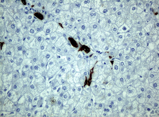 KRT19 / CK19 / Cytokeratin 19 Antibody - Immunohistochemical staining of paraffin-embedded human liver tissue using anti-KRT19 mouse monoclonal antibody. Anti-KRT19 clone UMAB2 was diluted 1:100; used heat-induced epitope retrieval by 10mM citric buffer, pH6.0, 120C for 3min to produce strong staining on the bile duct and no staining in the hepatocytes.