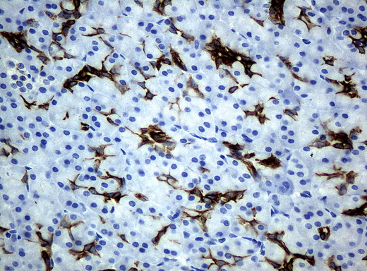 KRT19 / CK19 / Cytokeratin 19 Antibody - Immunohistochemical staining of paraffin-embedded pancreas tissue using anti-KRT19mouse monoclonal antibody. (Clone UMAB3, dilution 1:100; heat-induced epitope retrieval by 10mM citric buffer, pH6.0, 120C for 3min)