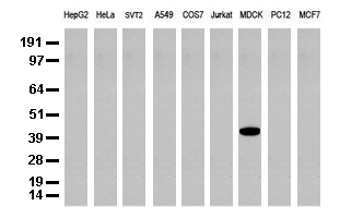 KRT19 / CK19 / Cytokeratin 19 Antibody - Western blot analysis of extracts. (35ug) from 9 different cell lines by using anti-CK19 monoclonal antibody. (Clone UMAB3) at 1:500.