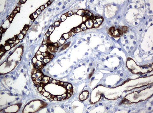 KRT19 / CK19 / Cytokeratin 19 Antibody - Immunohistochemical staining of paraffin-embedded Kidney tissue using anti-KRT19mouse monoclonal antibody. (Clone UMAB3, dilution 1:100; heat-induced epitope retrieval by 10mM citric buffer, pH6.0, 120C for 3min)