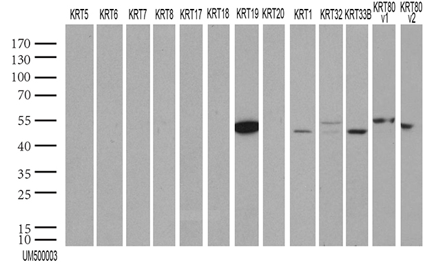 KRT19 / CK19 / Cytokeratin 19 Antibody - HEK293T were transfected with 55 different plasmids of CK cDNA. (1, 2, 4, 5, 6a, 6b, 6c, 7, 8, 9, 12, 13, 14, 15, 16, 17, 18 v1, 18 v2, 19, 20, 24, 25, 26, 27, 28, 31, 32, 33a, 33b, 34, 35, 36, 37, 38, 39, 40, 71, 72 v1, 72 v3, 73, 74, 75, 76, 77, 78, 79, 80 v1, 80 v2, 81, 82, 83, 84, 85, 86 and 222) for 48hrs and lysed. Cell lysates. (5 ug per lane) were separated by SDS-PAGE and blotted with KRT19 antibody. KRT12, 19, 25, 26, 27, 28 and 39 were positive, while all others were negative. (1:500)