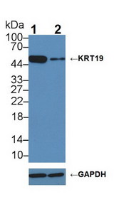 KRT19 / CK19 / Cytokeratin 19 Antibody - Knockout Varification: Lane 1: Wild-type HepG2 cell lysate; Lane 2: KRT19 knockout HepG2 cell lysate; Predicted MW: 44kDa Observed MW: 50kDa Primary Ab: 2µg/ml Rabbit Anti-Human KRT19 Antibody Second Ab: 0.2µg/mL HRP-Linked Caprine Anti-Rabbit IgG Polyclonal Antibody