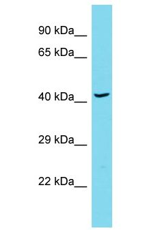 KRT19 / CK19 / Cytokeratin 19 Antibody - KRT19 / CK19 / Cytokeratin 19 antibody Western Blot of Thymus Tumor. Antibody dilution: 1 ug/ml.  This image was taken for the unconjugated form of this product. Other forms have not been tested.