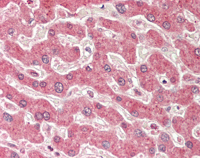 KRT19 / CK19 / Cytokeratin 19 Antibody - Human Liver: Formalin-Fixed, Paraffin-Embedded (FFPE).  This image was taken for the unconjugated form of this product. Other forms have not been tested.