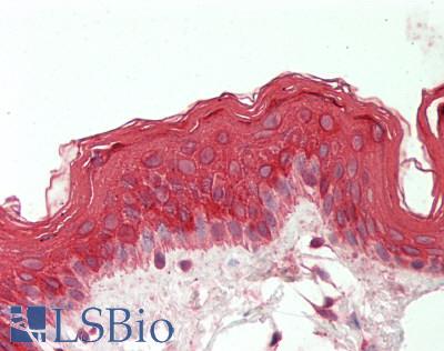 KRT19 / CK19 / Cytokeratin 19 Antibody - Human Skin: Formalin-Fixed, Paraffin-Embedded (FFPE).  This image was taken for the unconjugated form of this product. Other forms have not been tested.