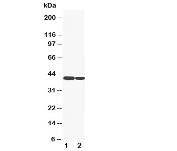 KRT19 / CK19 / Cytokeratin 19 Antibody - Western blot testing of Cytokeratin 19 antibody and Lane 1: HT1080; 2: COLO320 cell lysate