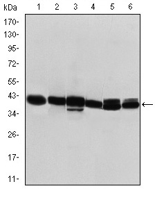 KRT19 / CK19 / Cytokeratin 19 Antibody - Western blot using KRT19 mouse monoclonal antibody against T47D (1), MCF-7 (2), SKBR-3 (3), HepG2 (4), Caco-2 (5) and SW620 (6) cell lysate.