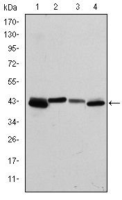 KRT19 / CK19 / Cytokeratin 19 Antibody - Cytokeratin 19 Antibody in Western Blot (WB)