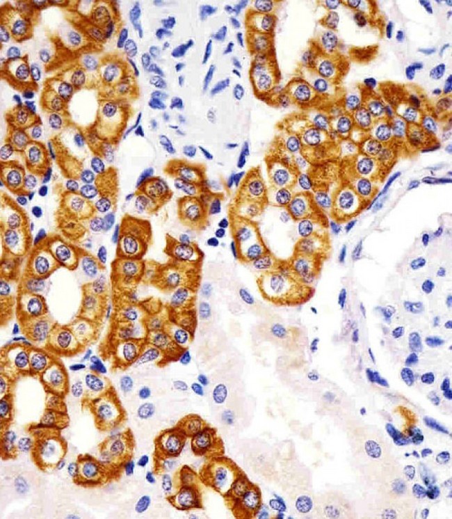 KRT19 / CK19 / Cytokeratin 19 Antibody - Antibody staining KRT19 in human kidney sections by Immunohistochemistry (IHC-P - paraformaldehyde-fixed, paraffin-embedded sections). Tissue was fixed with formaldehyde and blocked with 3% BSA for 0. 5 hour at room temperature; antigen retrieval was by heat mediation with a citrate buffer (pH 6). Samples were incubated with primary antibody (1:25) for 1 hours at 37°C. A undiluted biotinylated goat polyvalent antibody was used as the secondary antibody.