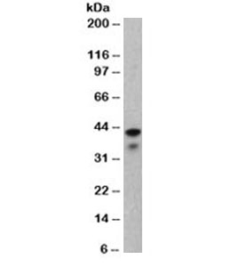 KRT19 / CK19 / Cytokeratin 19 Antibody - Western blot testing of MCF7 lysate with Keratin 19 antibody (clone BA17). This image was taken for the unmodified form of this product. Other forms have not been tested.