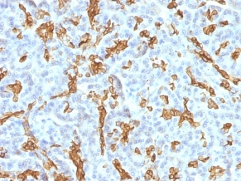 KRT19 / CK19 / Cytokeratin 19 Antibody - Formalin-fixed, paraffin-embedded human pancreas stained with Cytokeratin 19 antibody (KRT19/799 + KRT19/800).  This image was taken for the unmodified form of this product. Other forms have not been tested.