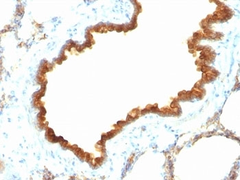 KRT19 / CK19 / Cytokeratin 19 Antibody - Formalin-fixed, paraffin-embedded rat lung stained with CK19 antibody.  This image was taken for the unmodified form of this product. Other forms have not been tested.