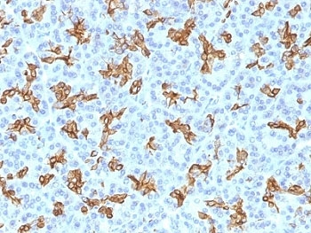 KRT19 / CK19 / Cytokeratin 19 Antibody - Formalin-fixed, paraffin-embedded human pancreas stained with CK19 antibody.  This image was taken for the unmodified form of this product. Other forms have not been tested.