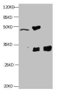 KRT19 / CK19 / Cytokeratin 19 Antibody - All lanes:Mouse anti-Human Cyfra21-1(KS19.1) monoclonal antibody at 4ug/ml Lane 1: MCF7 cell lysate Lane2: MDA-MB-231 cell lysate Lane3: HepG-2 cell lysate Secondary HRP labeled Goat polyclonal to Mouse IgG at 1/3000 dilution Predicted band size : 30 kDa Observed band size : 32 kDa Additional bands at: 50kd