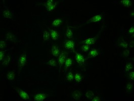 KRT19 / CK19 / Cytokeratin 19 Antibody - Immunofluorescent staining of HeLa cells using anti-KRT19 mouse monoclonal antibody.